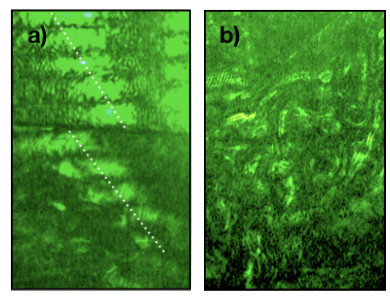 Intra-Cavity Image